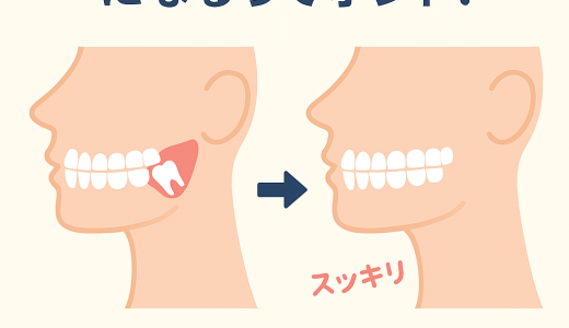 親知らずを抜くと小顔になるってホント？歯科衛生士が本音で解説！